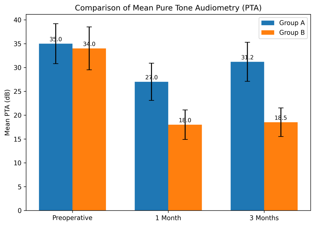Figure 1: Comparison of Mean Pre and Post Operative Audiogram.